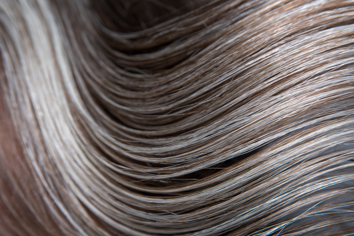 Hair Repigmentation Reported With Baricitinib in Canities Subita
