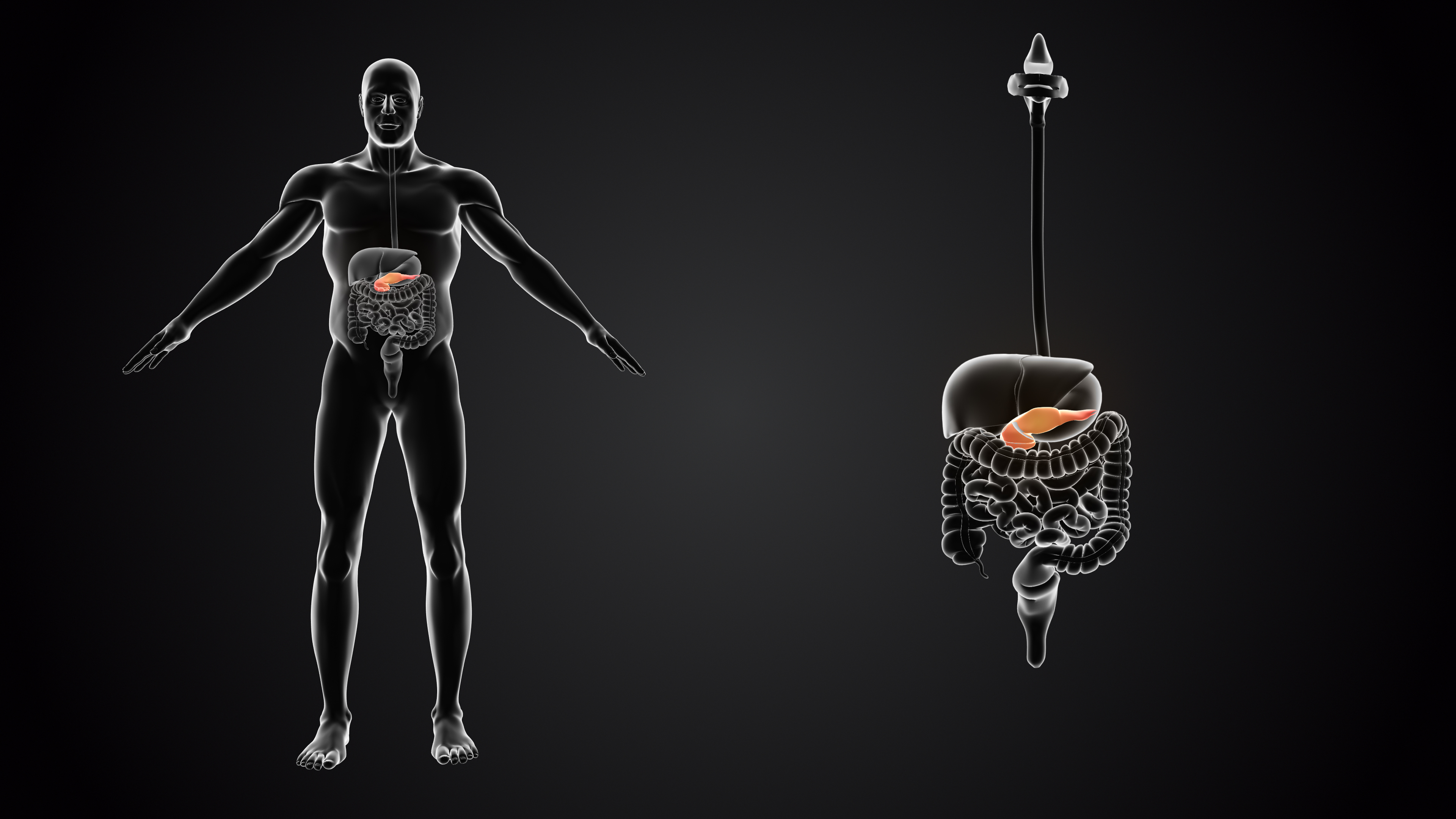 factors that increase pancreatitis risk with glp 1 initiation GLP-1 Receptor Agonists and of Acute and Pancreatic Cancer: A Real-World Comparative Study Glucagon-Like Peptide-1 Receptor Agonists and
